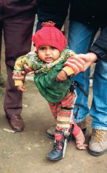 a polio child in uttar pradesh