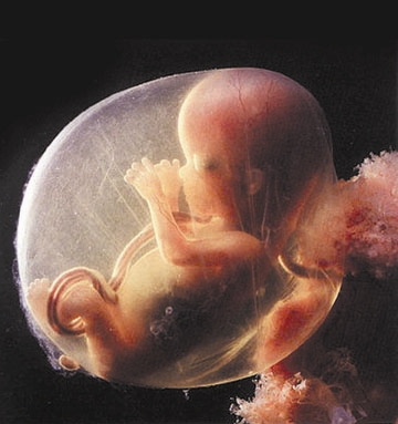 female fetus
