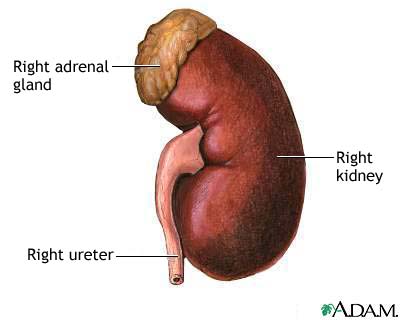 kidney racket uncovered