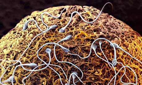 sperm xd965 15839