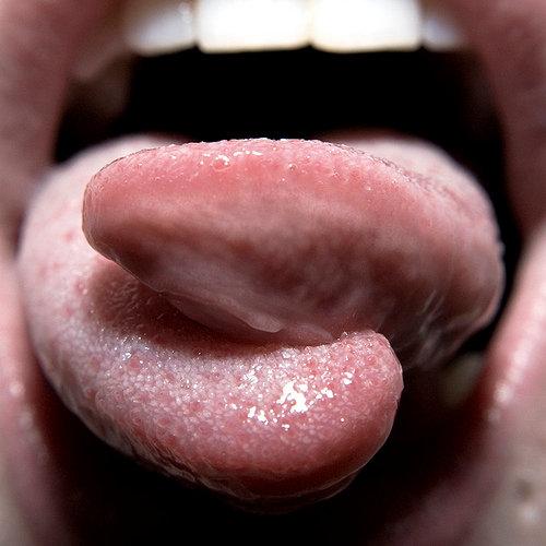 Tongue split